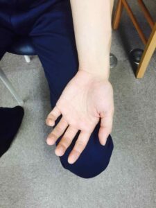 これで力を抜いた状態です。一目で曲がった状態が「普通」になっていることがわかります