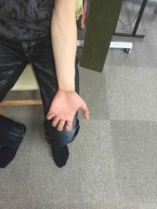 まだ少し曲がっていますが、比べるとかなり改善していることがわかります